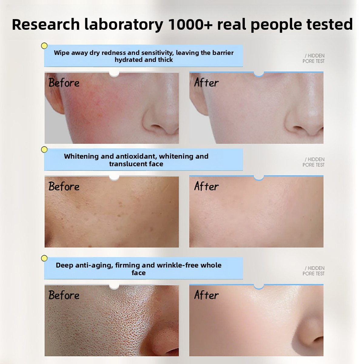 Ruyi Vitamin E Niacinamide Fac - Skincare Niacinamide reseña y precio
