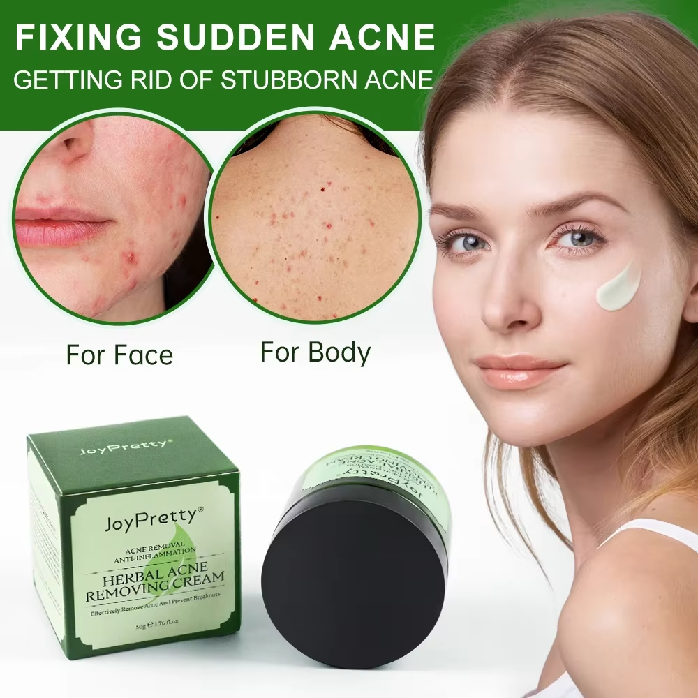 JoyPrettyin Herbal Acne Face C - Skincare Herbal reseña y precio