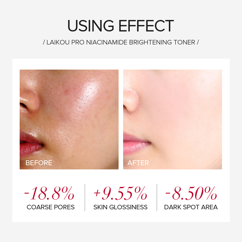 LAIKOU PRO Niacinamide 4Pcs Br - Skincare Niacinamide reseña y precio