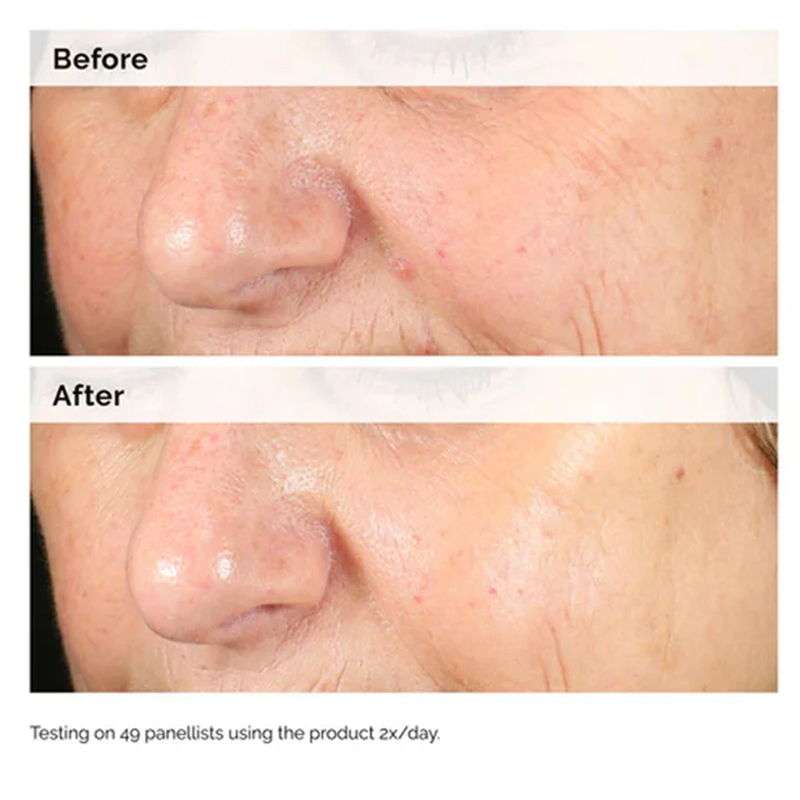 Alpha Arbutin 2% + HA 30ml Ser - Alpha Arbutin Serum reseña y precio