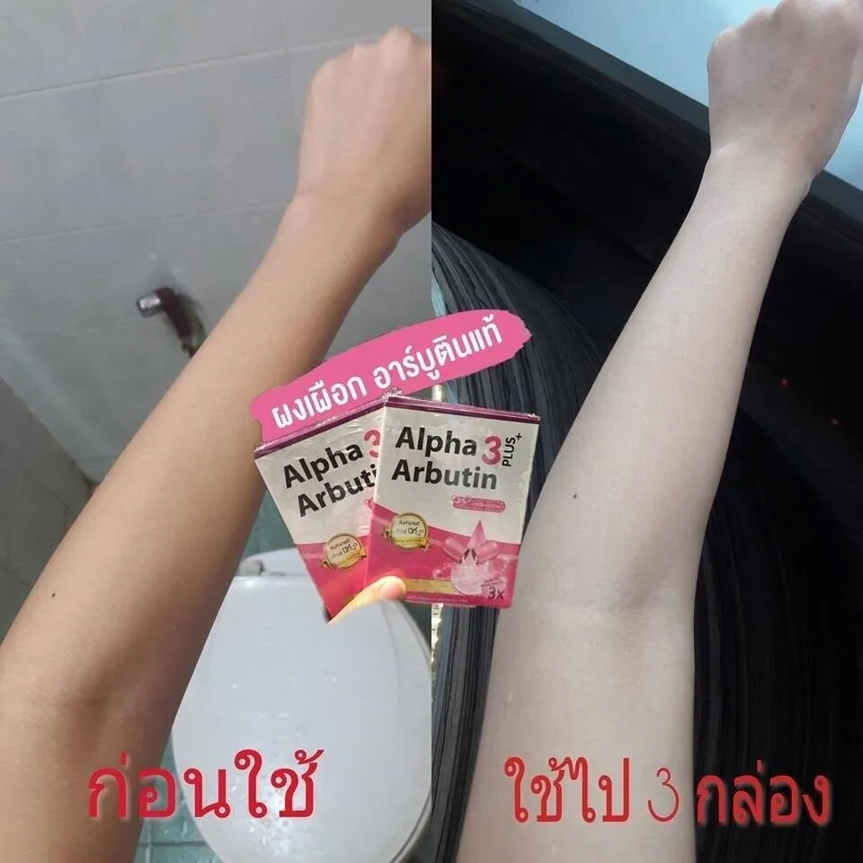 8X Alpha Arbutin 3 Plus Powder - Alpha Arbutin Serum reseña y precio