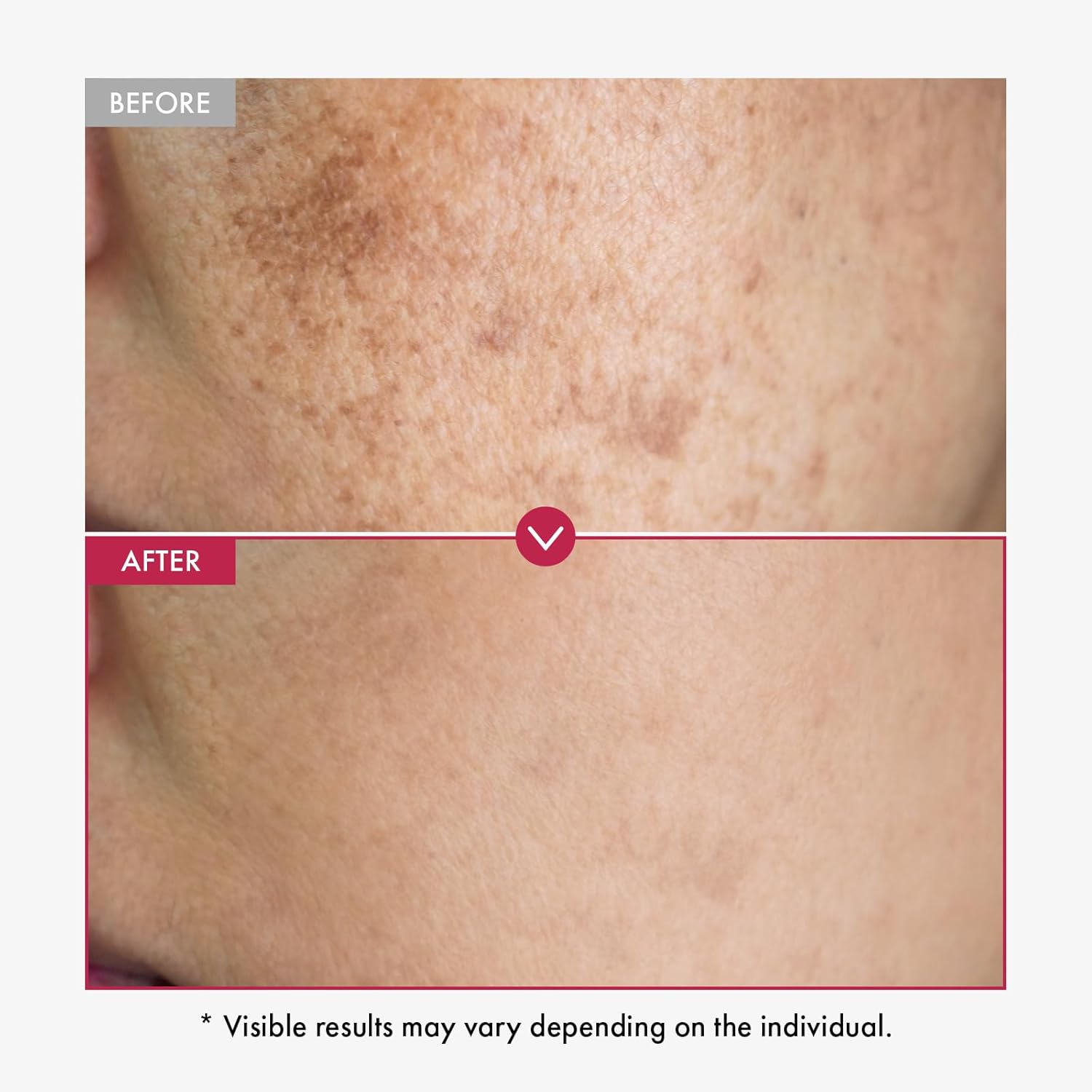 Alpha Arbutin Serum AHA Keeps  - Alpha Arbutin Serum reseña y precio
