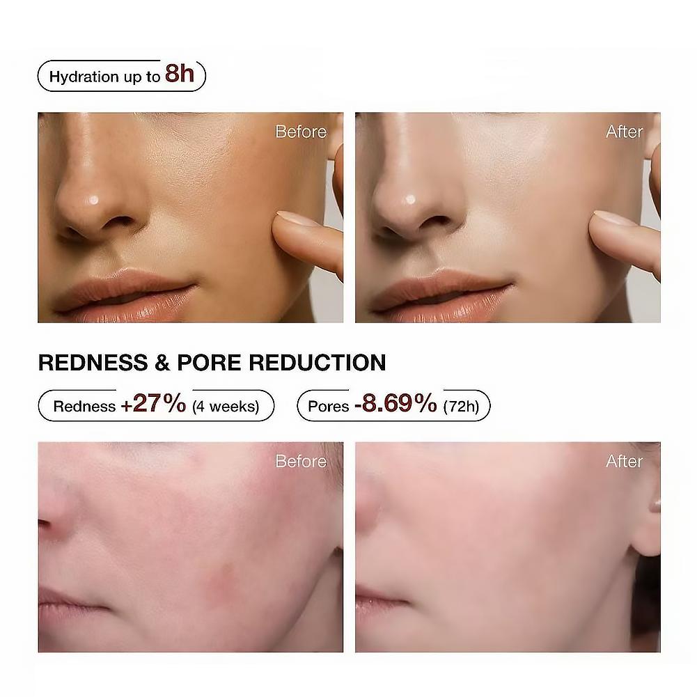 5% Niacinamide & Arbutin Serum - Alpha Arbutin Serum reseña y precio