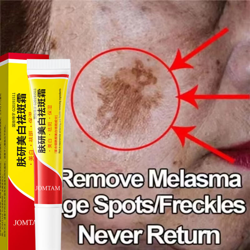 Whitening Freckle Cream Face B - Skincare Niacinamide reseña y precio