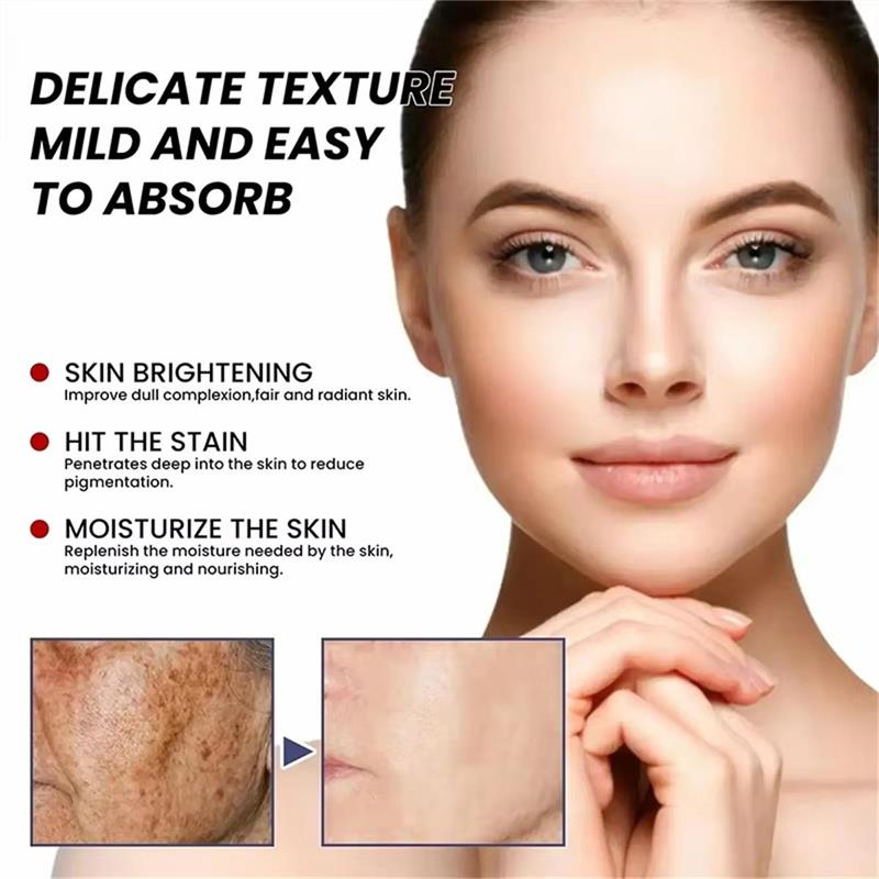Whitening Freckle Cream Face B - Skincare Niacinamide reseña y precio